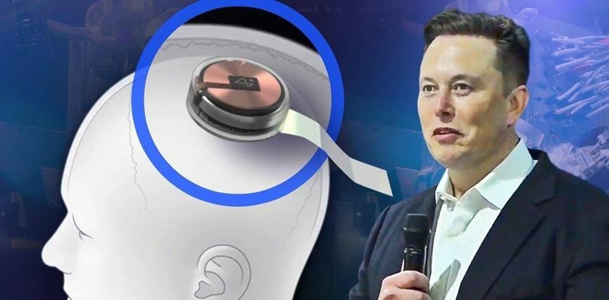 全球瞩目，马斯克旗下Neuralink公司启动大脑芯片试用寻找全球患者计划